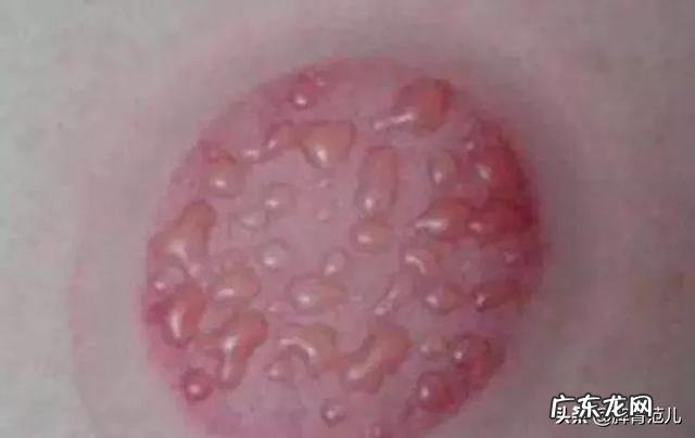 脾虚则便溏，大便不成形意味着脾虚，也意味着体内有湿气？