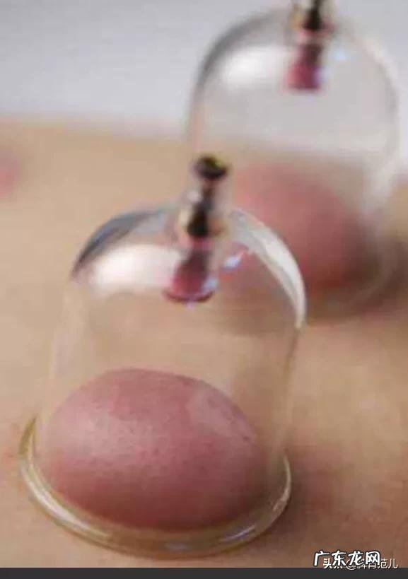 脾虚则便溏，大便不成形意味着脾虚，也意味着体内有湿气？