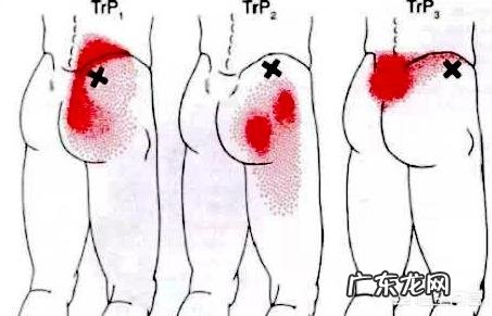 每次拉完引体向上后右胳膊关节疼，为什么