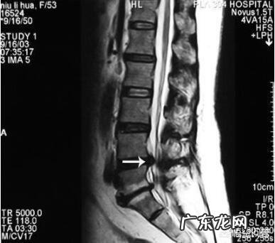 每次拉完引体向上后右胳膊关节疼，为什么