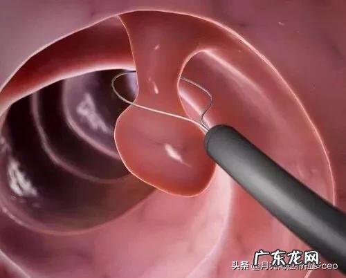 刚采摘的玫瑰花骨朵如何制作玫瑰花茶?