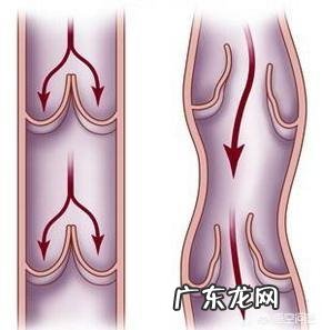 小腿出现了静脉曲张，还能跑步、跳绳吗？