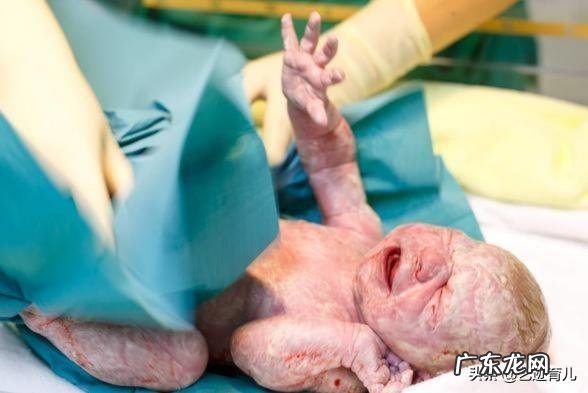 diyi胎,你们最担心的是什么?