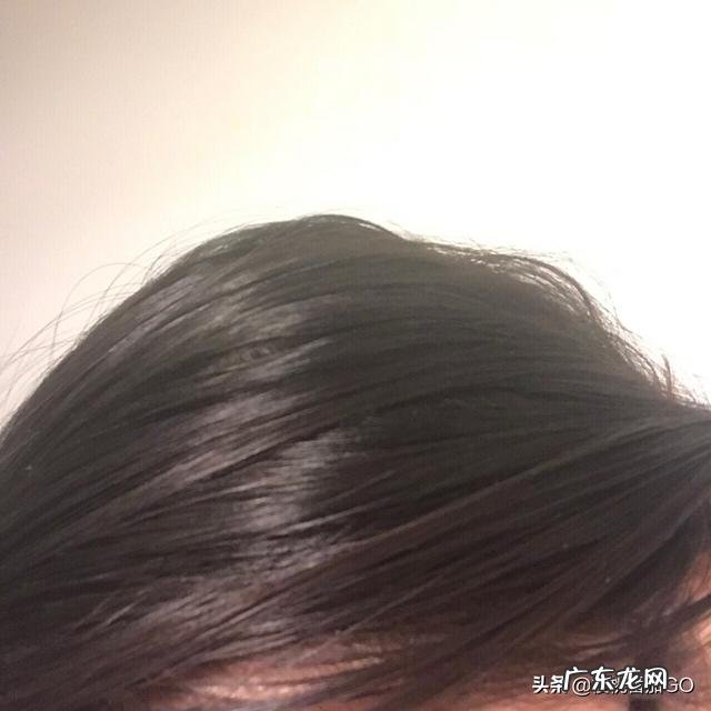 我头皮爱出油天天洗还是油大家有没有什么好的控油方法