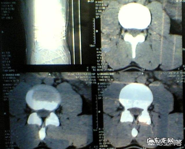 我腰间盘膨出半年，每次锻炼都很疼，还能坚持锻炼吗？