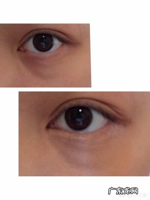 去黑眼圈细纹效果好的眼霜 有哪些去黑眼圈、淡化细纹的眼霜,可以推荐