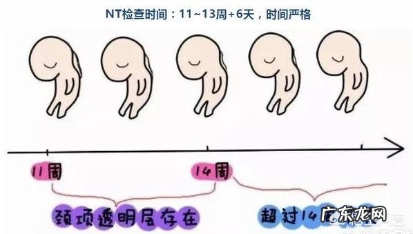 孕妈的diyi次产前筛查很重要,为啥要做NT筛查何时做NT筛查