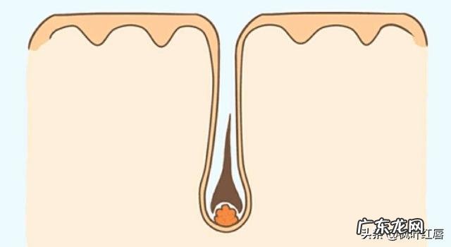 人身体上有痣的地方大多会长体毛为什么