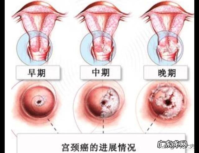 做饭炒菜时哪些习惯会增加癌症风险