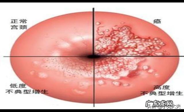 做饭炒菜时哪些习惯会增加癌症风险