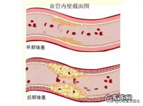 患有高血脂的人都有什么表现？