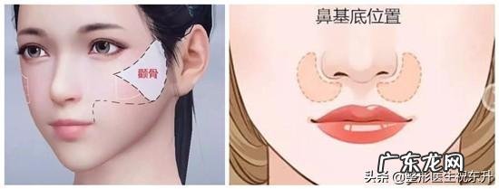 法令纹是怎么形成的？有方法改善吗？