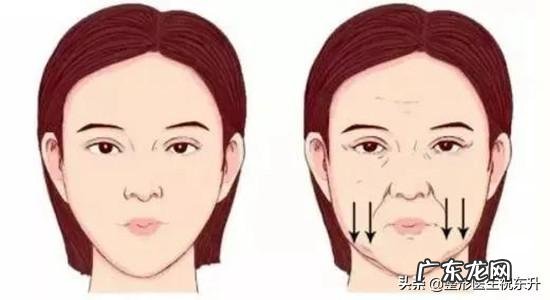 法令纹是怎么形成的？有方法改善吗？