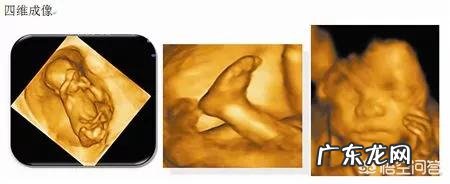 女性怀孕前为什么最好要查一下甲状腺