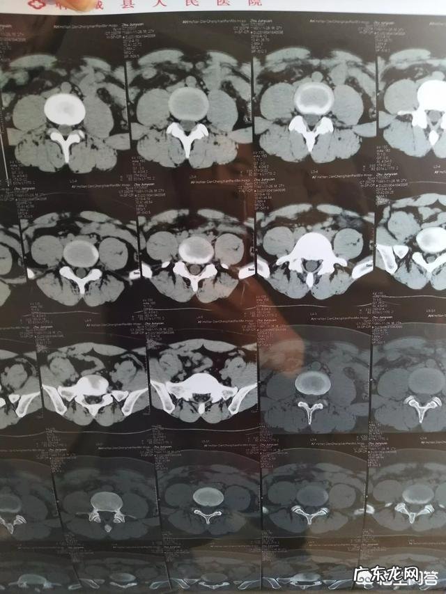 我有骨质增生,腰间盘膨出能去健身房吗?