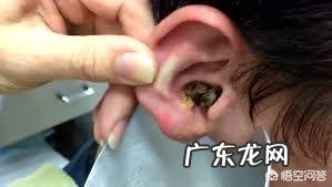 女人身上有股气味是怎么回事?