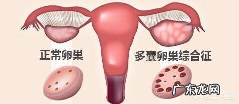 力量训练加有氧也少吃了，不见瘦，该怎么办