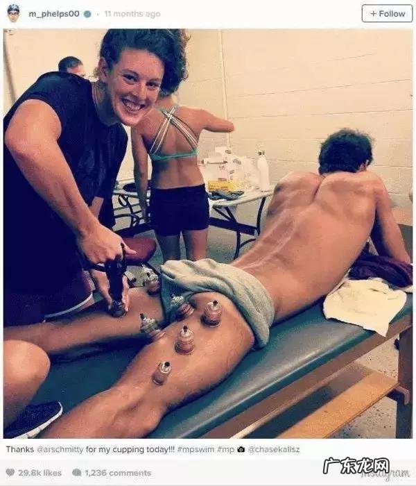 为什么肩膀拔罐特别黑 身上肩膀处每次拔罐都很黑怎么回事?