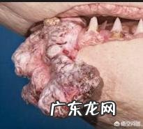 癌症病因以及癌症的zhi疗方法是怎样的呢你怎么看