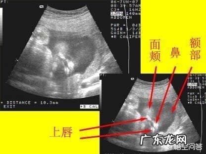 作为一个母亲无论遇到多大的事 作为母亲，可以坚强到何种程度？