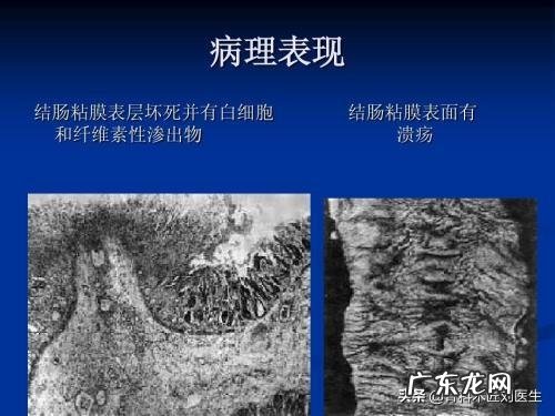 男尿完了马上又有尿意怎么回事 男人尿完尿还有尿意是怎么回事?