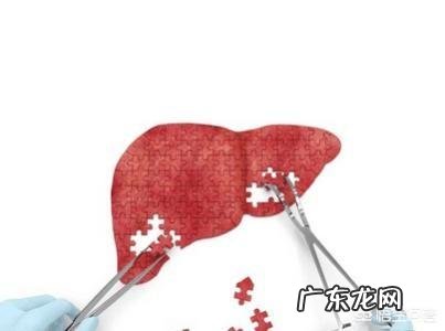 肝硬化到什么样程度才检查出是晚期?