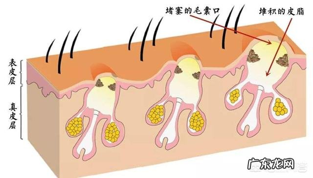 皮肤到底会不会呼吸，化妆会增加皮肤负担吗？