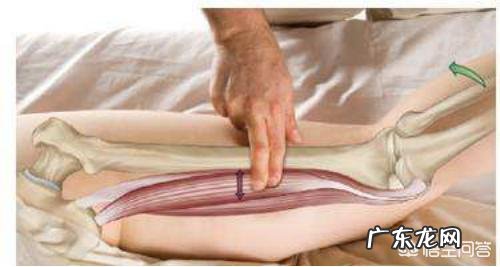 如何后天矫正不漂亮的腿型？