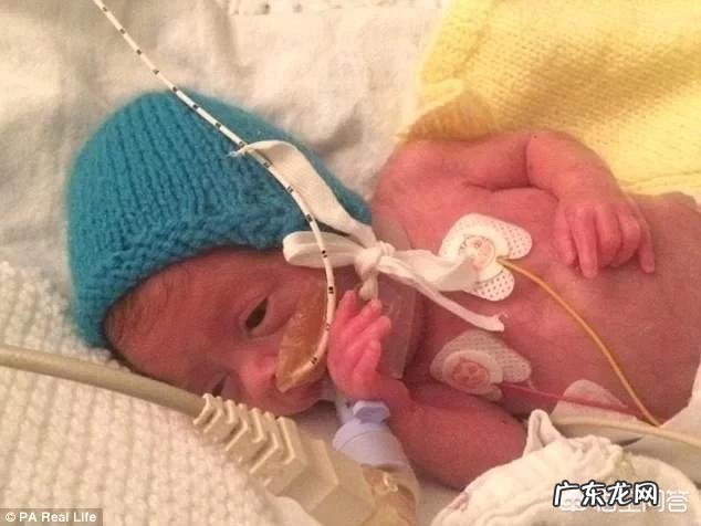 怀孕32周早产,宝宝体重4.8斤,进了保温箱,多久可以回家?