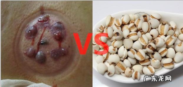 拔罐的功效与作用是什么?