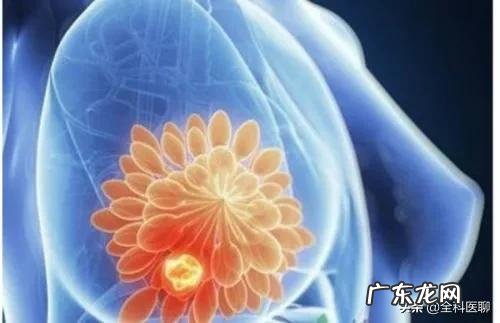 哪些人容易得乳腺癌？该如何diyi时间排查乳腺癌？