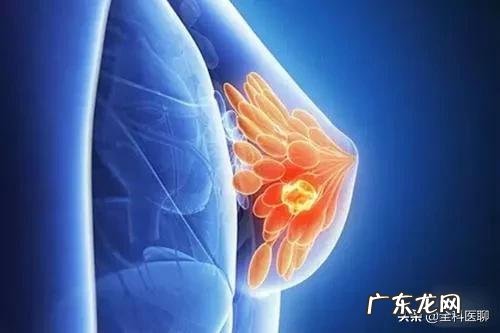 哪些人容易得乳腺癌？该如何diyi时间排查乳腺癌？
