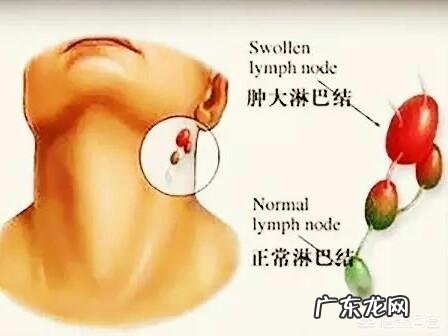 喝什么茶可以预防三高 喝什么茶可以预防鼻咽癌?