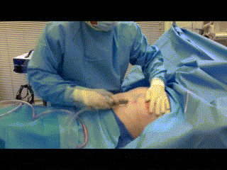 男人胸大如何瘦下去 男人太胖导致胸太大怎么瘦下去?