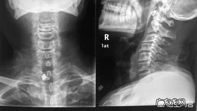 如何保养颈部预防颈部皱纹