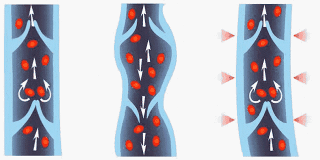 裤袜在秋冬的季节如何选择?