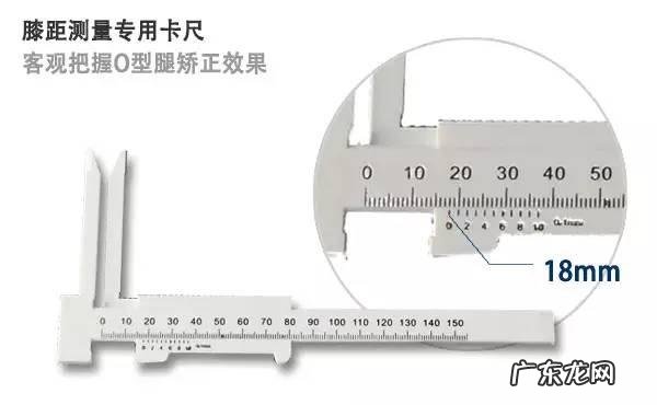 33岁的o型腿靠锻炼能矫正过来吗 O型腿,腿不直怎么办?能通过锻炼纠正吗?
