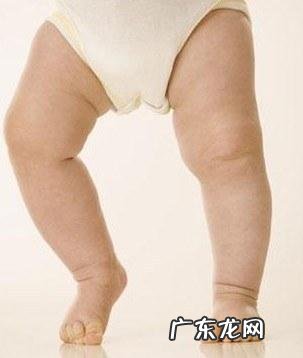 33岁的o型腿靠锻炼能矫正过来吗 O型腿,腿不直怎么办?能通过锻炼纠正吗?