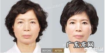 超声刀和蛋白埋线各有什么优缺点？