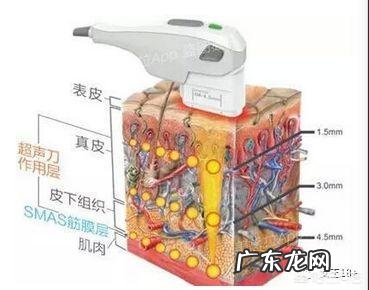 超声刀和蛋白埋线各有什么优缺点？