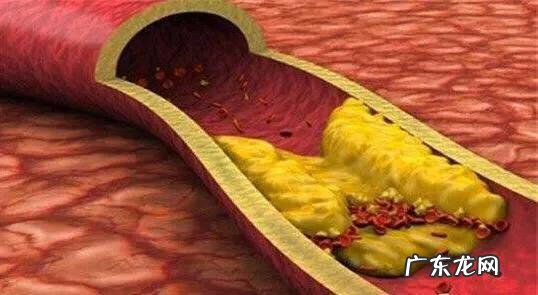 吃核桃会使甘油三脂升高吗？