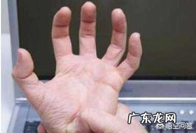 运动神经元病是属于哪类病,如何辨别、证明?