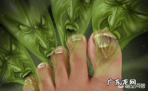 脚臭可以彻底根除吗?怎么才能除脚臭?