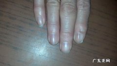 指甲上的月牙少真的是不健康的表现吗？