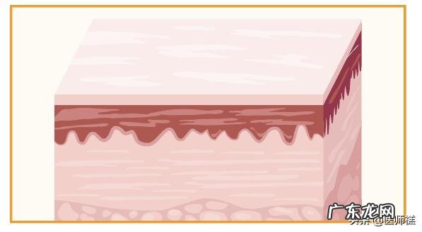 经常口腔溃疡,有什么方法缓解?