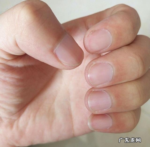 指甲上的月牙少表示身体亚健康科不科学?