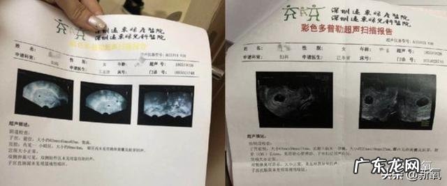 女明星中,你觉得谁长相比较娇小可人