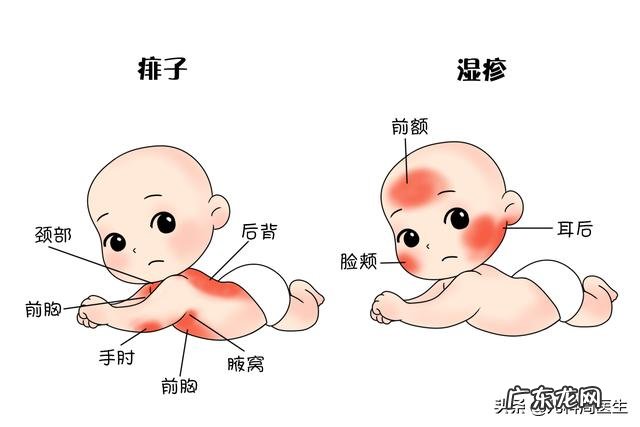 宝宝经常起热痱子，是缺什么东西吗？