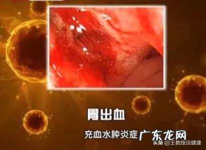 哪些不良的习惯会引起胃出血？