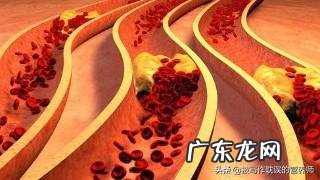 不方便运动怎么才能降低体脂率 体脂率高是否能通过饮食降低呢？脂肪只能通过运动消耗吗？